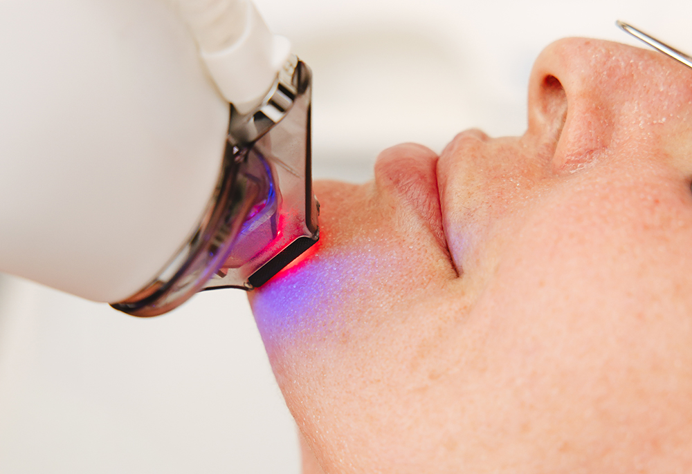 Laser hybrydowy HALO TRIBRID – pierwsza klinika w Polsce z tym urządzeniem, dr Pitucha