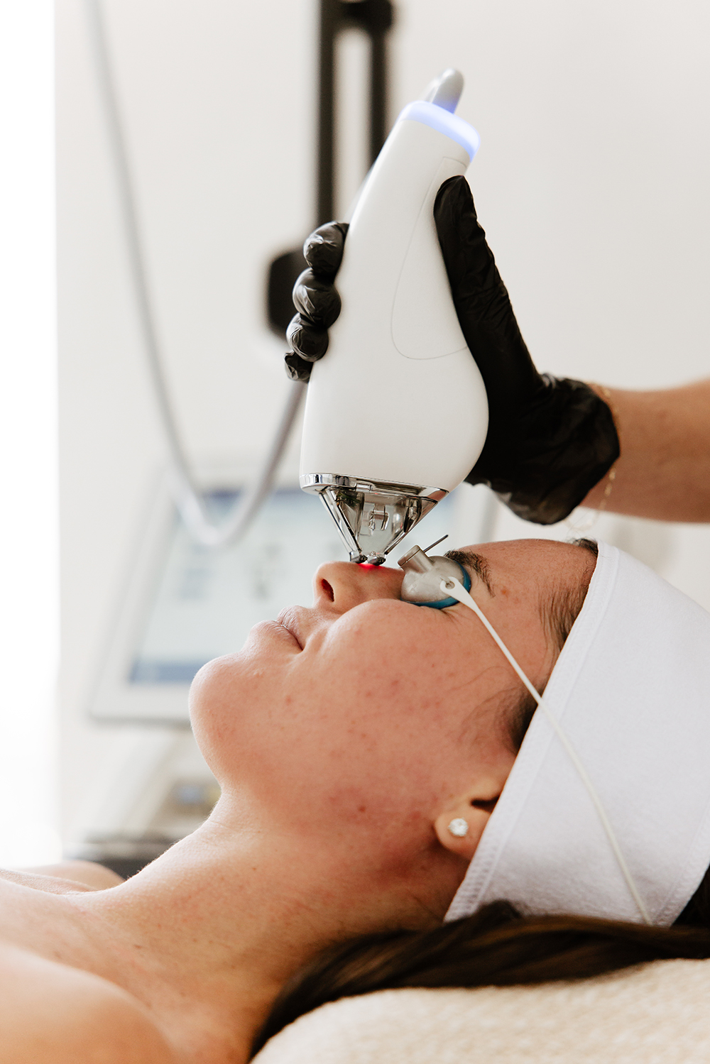 Laser tulowy nieablacyjny MOXI