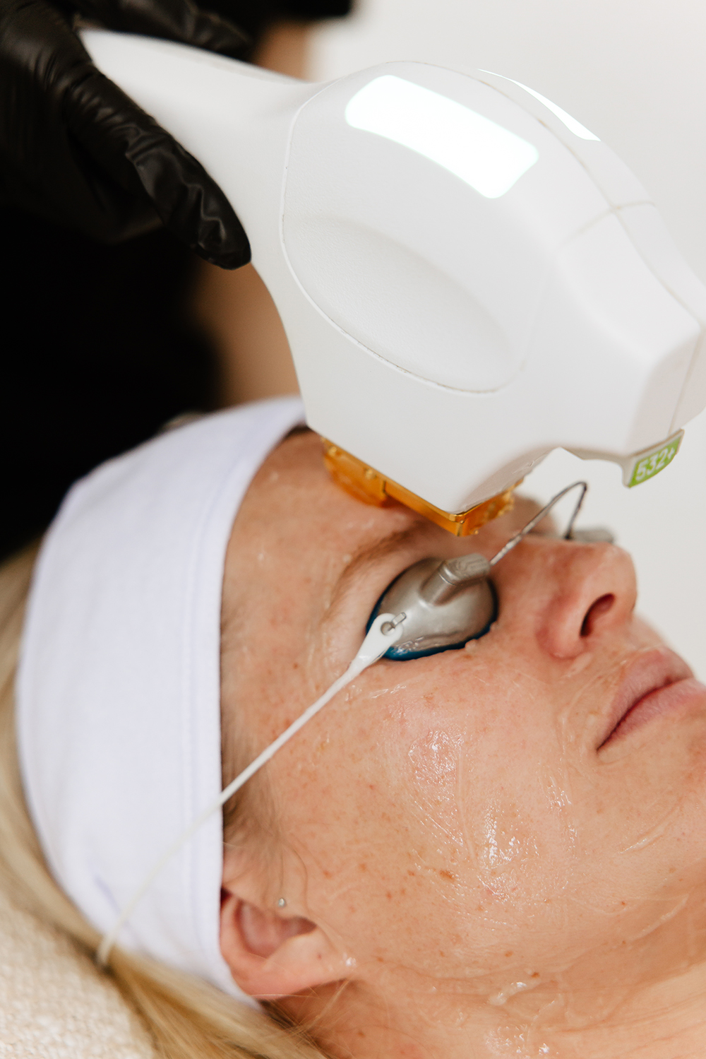 Fototerapia fotoodmłodzenie