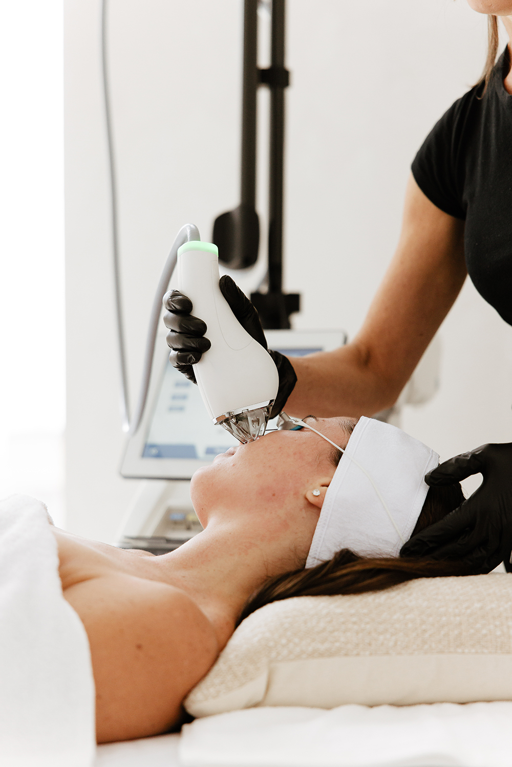 Zabieg laserem MOXI w klinice dr Pituchy – redukcja przebarwień i odmłodzenie