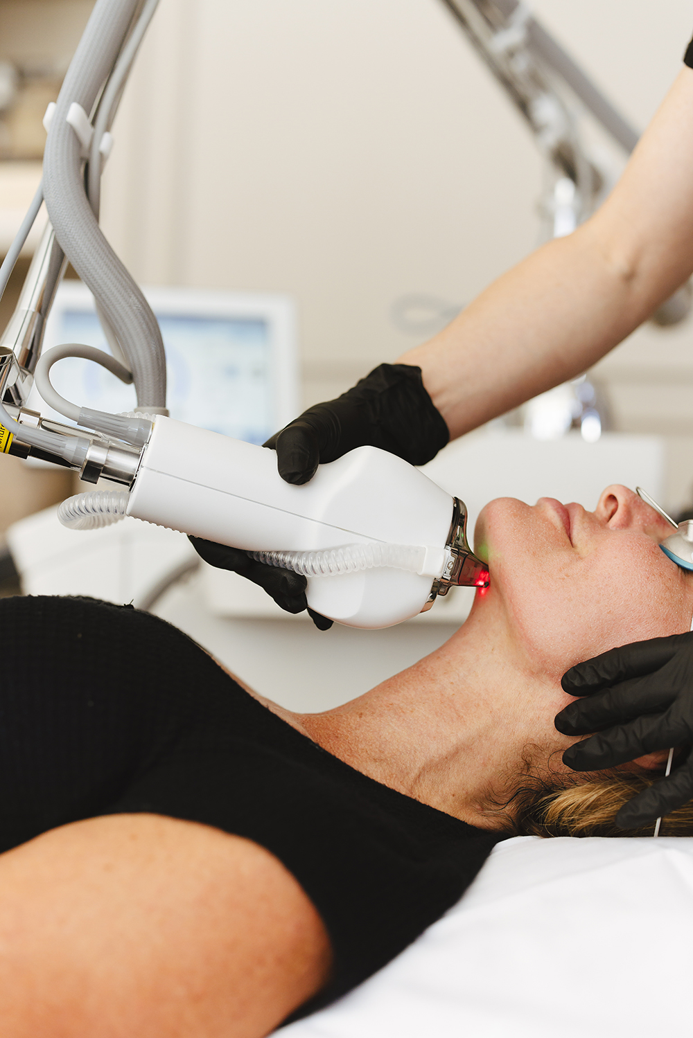 Efekty zabiegu HALO TRIBRID – wygładzona i odmłodzona skóra, dr Pitucha