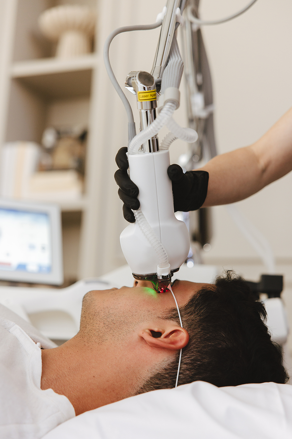 Klinika Aestheco Warsaw – zabieg laserem frakcyjnym HALO TRIBRID, dr Marek Pitucha