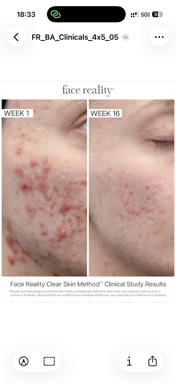 Face Reality clinical study example: week 1 and week 16