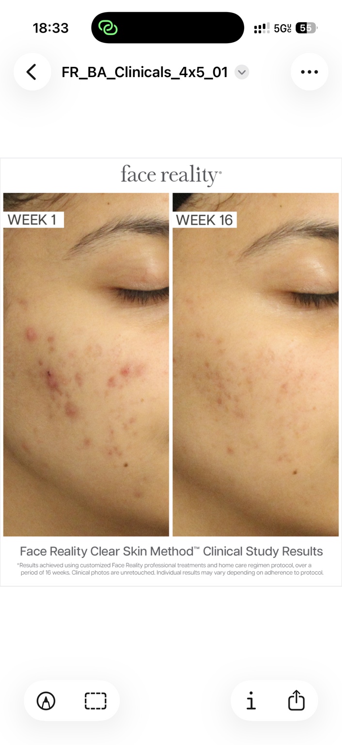 Face Reality clinical study example: week 1 and week 16