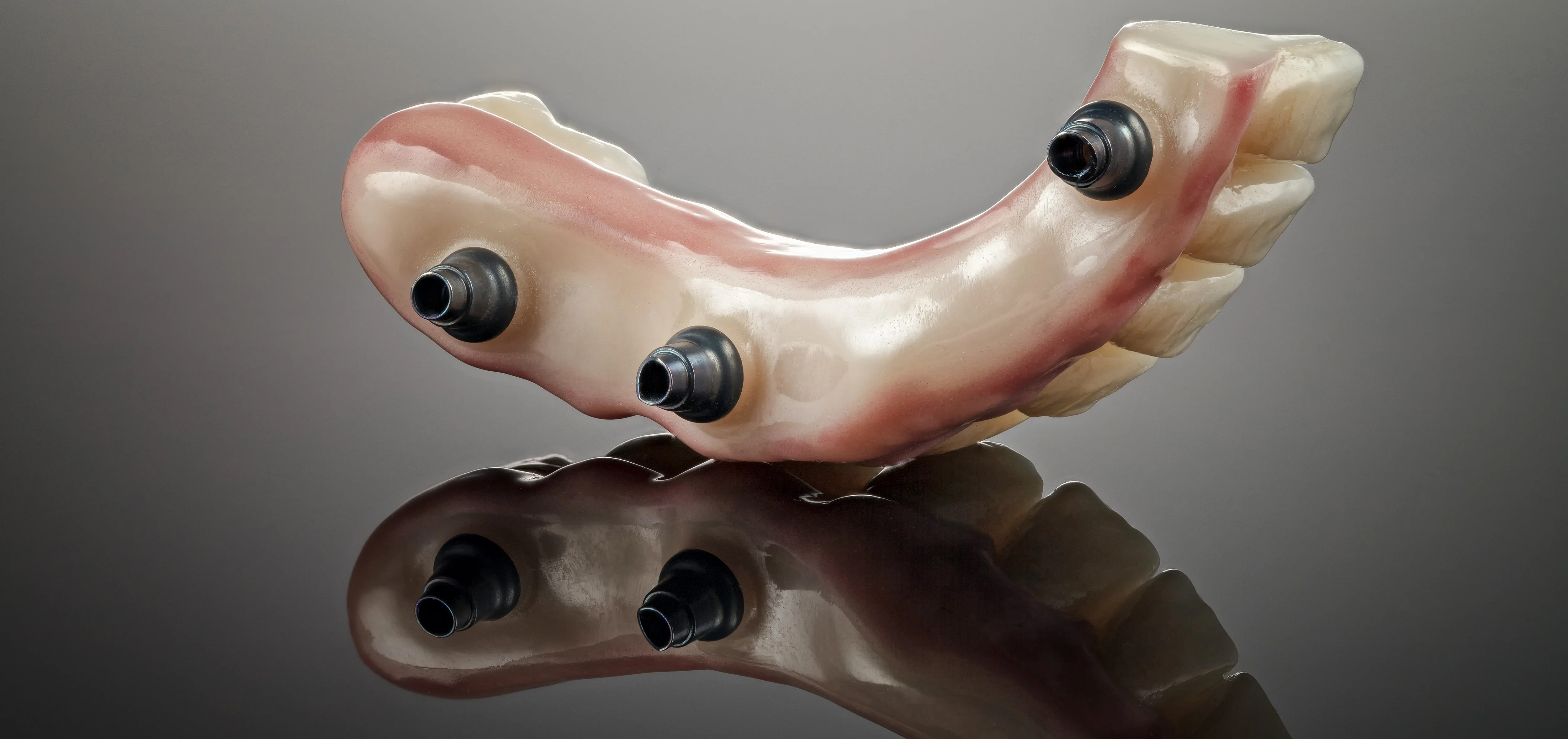 All-on-X Dental Implants