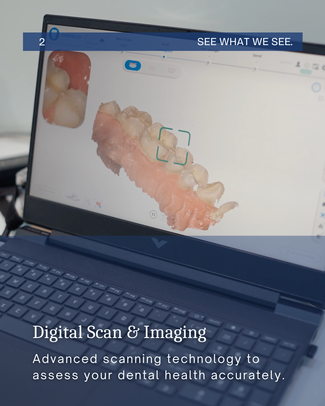 Digital dental scanning and imaging used to assess oral health at Smile Dental Kondapur