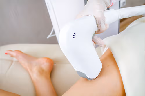 Laser Hair Removal