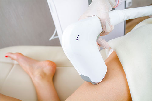 Laser Hair Removal
