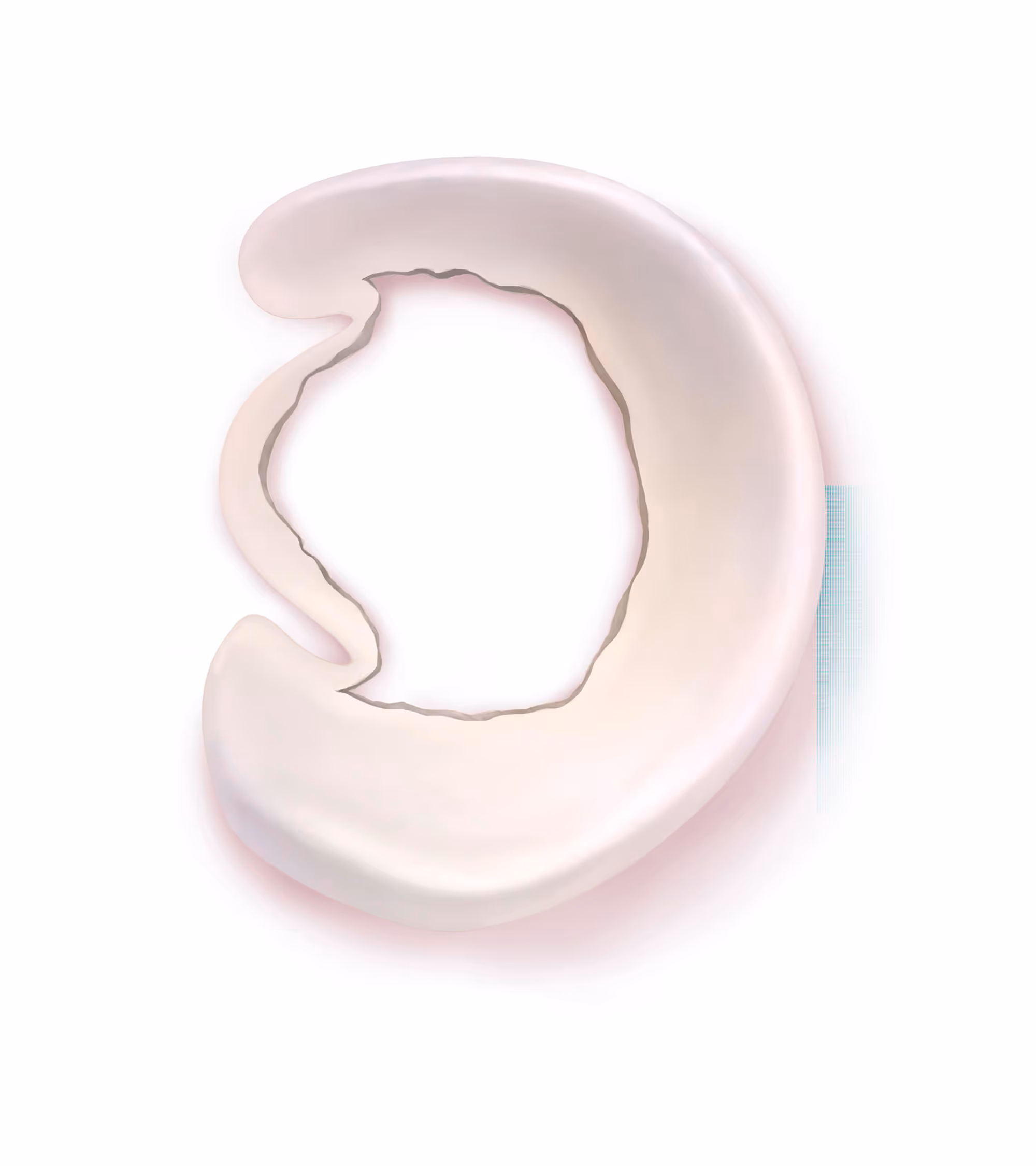 Schaubild Korbehenkelriss