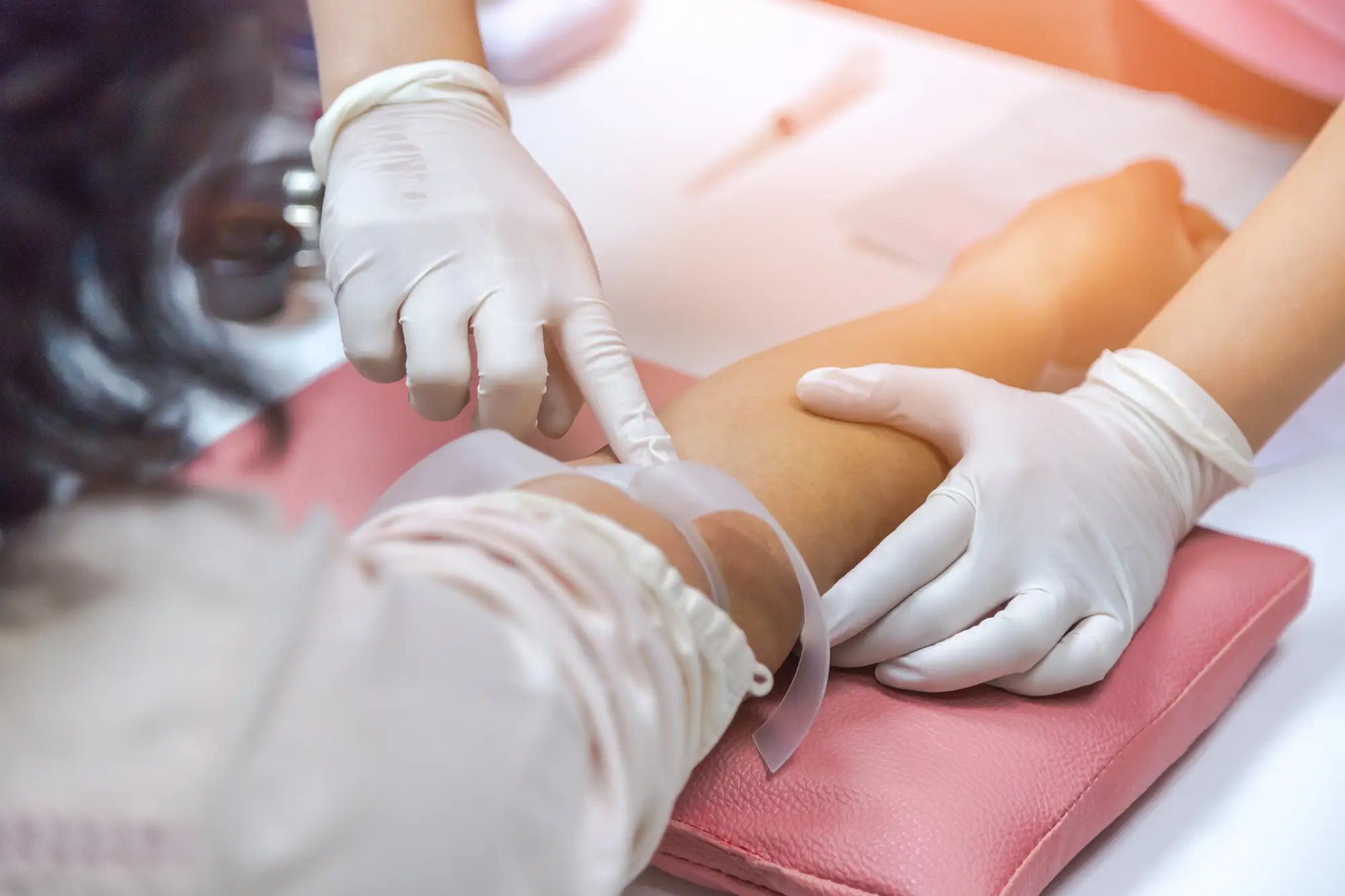 Medizinische Blutabnahme aus dem Arm zur Vorbereitung der Eigenbluttherapie.