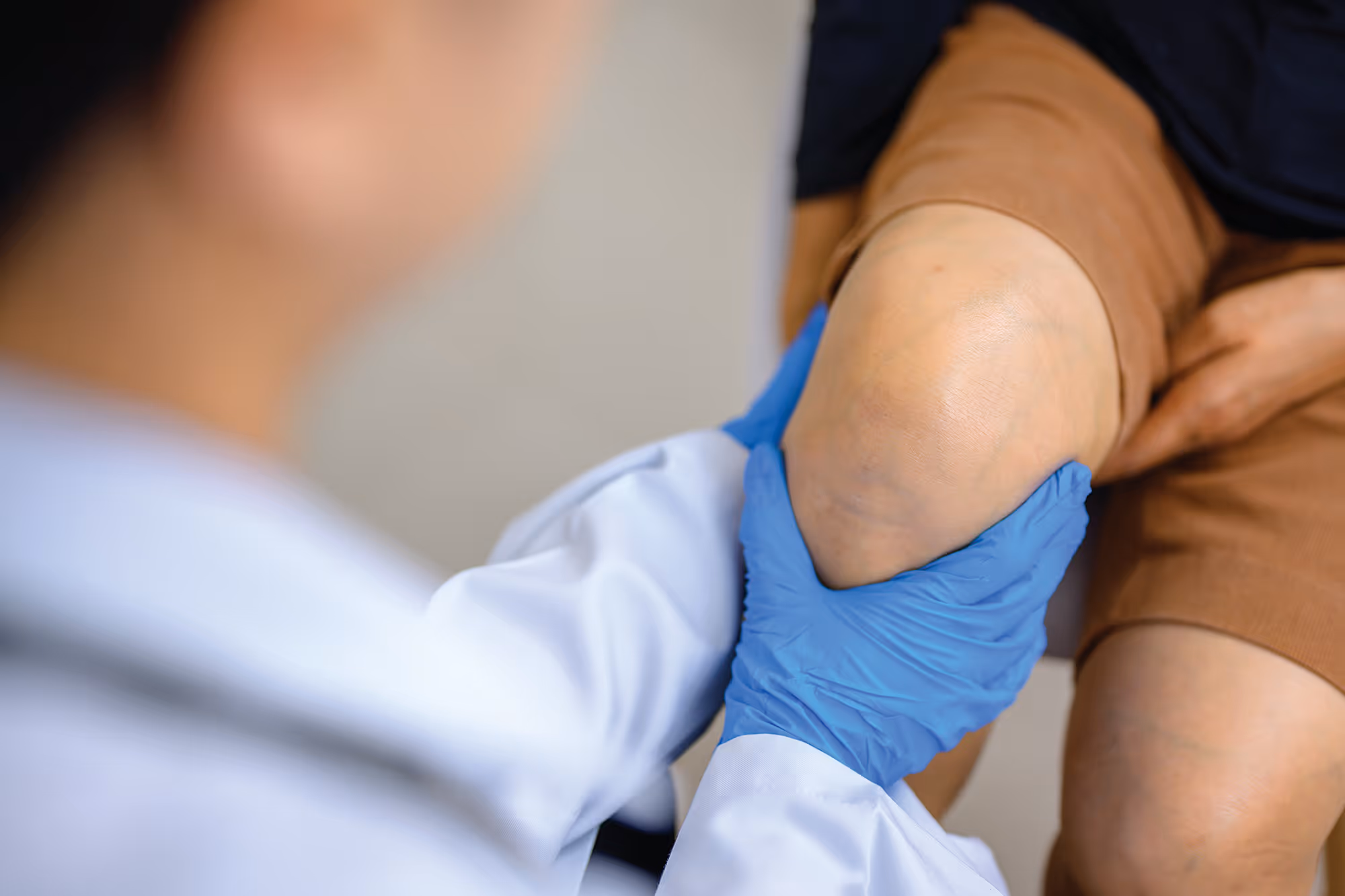 Meniskusschaden wie beispielsweise Meniskusriss