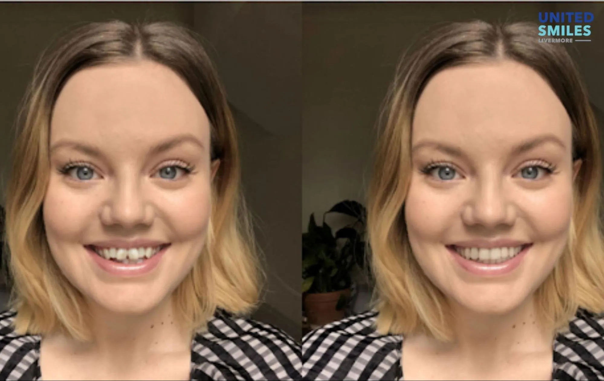 Teeth