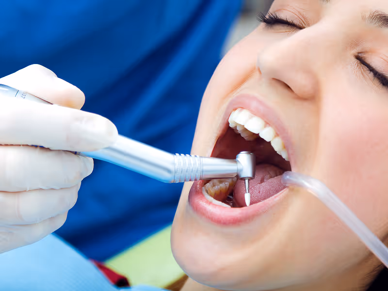 Close-up of a woman with eyes closed receiving dental treatment with a dental drill and suction tube inside her mouth.