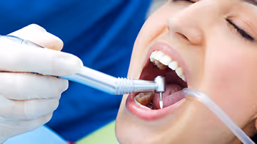 Close-up of a dental procedure with a patient receiving treatment; a gloved hand holds dental instruments inside the open mouth.