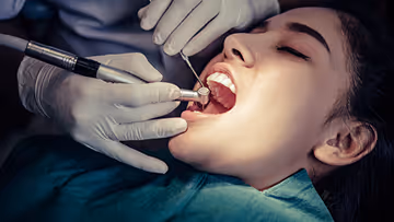 Close-up of a dental procedure where a dentist wearing gloves is working on a patient's open mouth with dental instruments.