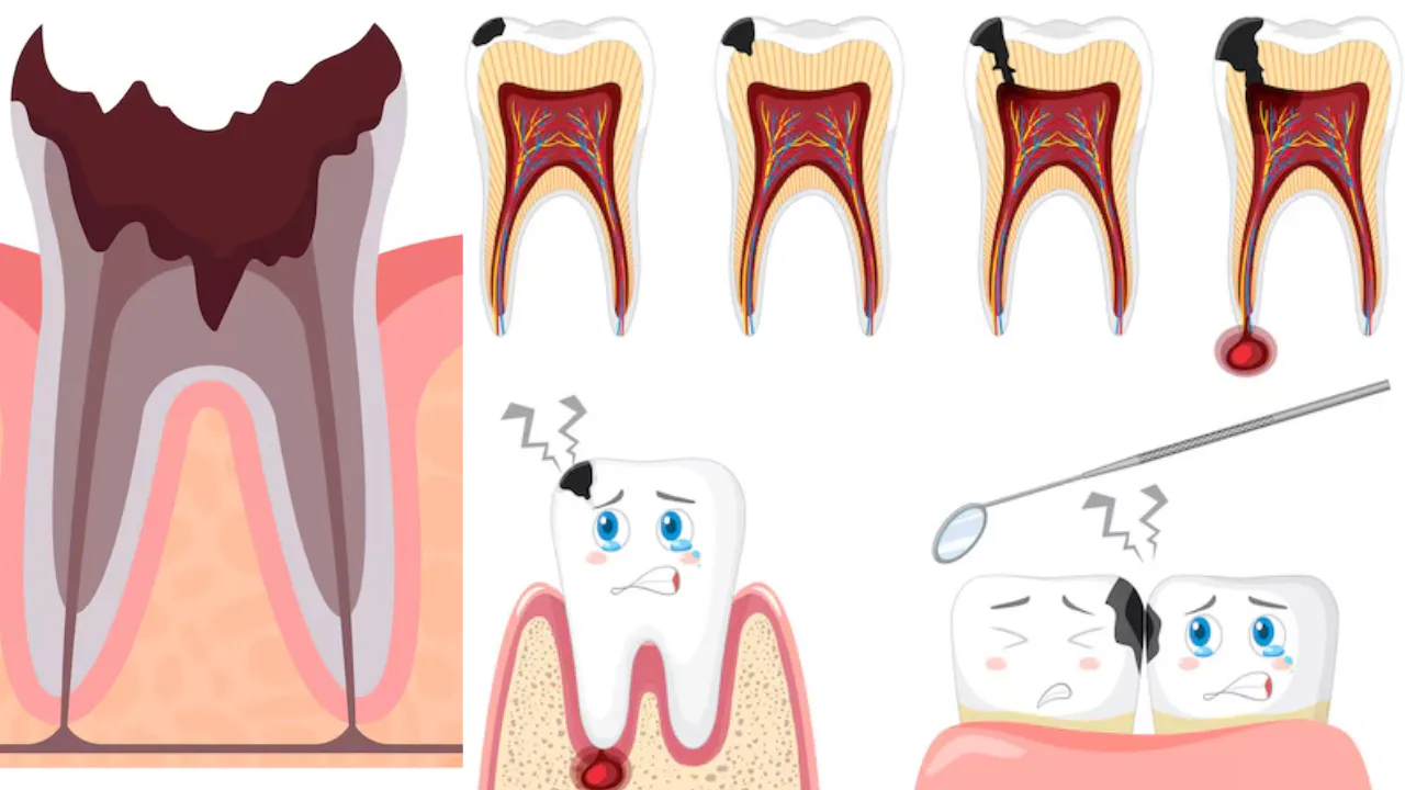 A man with toothache beside diagrams of tooth-root and gum inflammation
