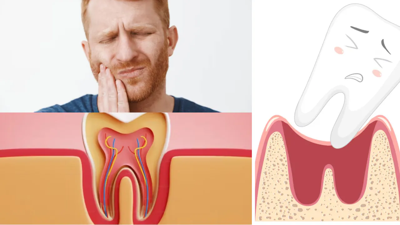 A man with toothache beside diagrams of tooth-root and gum inflammation