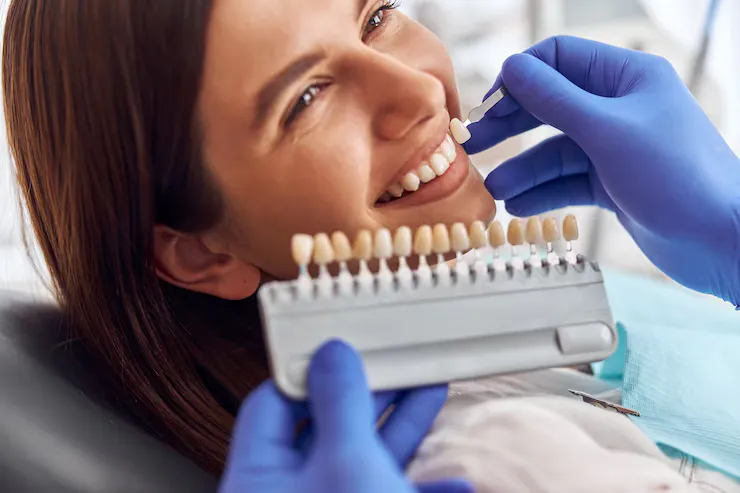 Dentist matching a tooth shade guide against a smiling woman's teeth for veneers