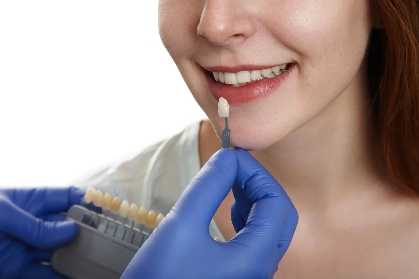 Dentist selecting a shade for a patient getting dental veneers