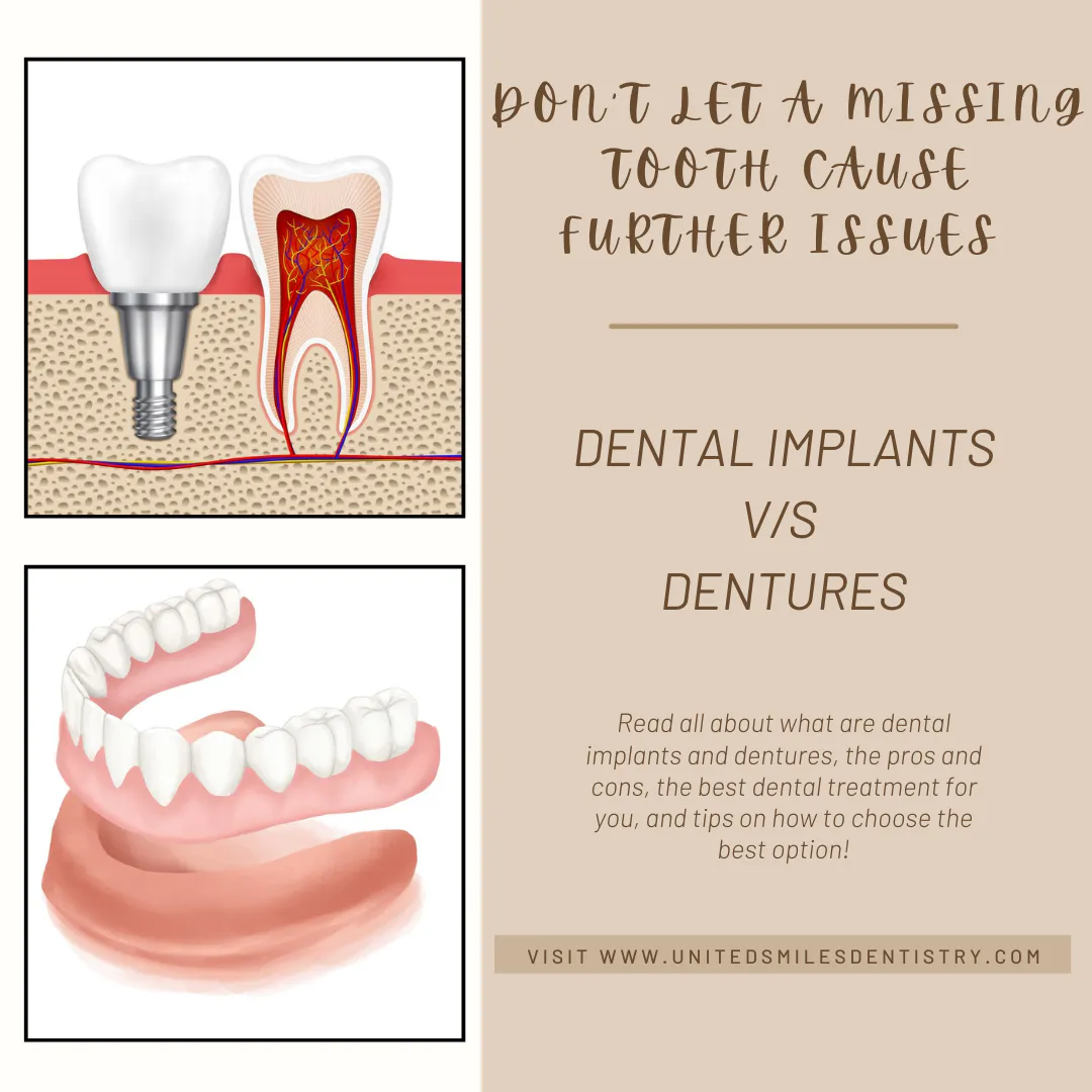 'Dental implants versus dentures' infographic from United Smiles Dentistry
