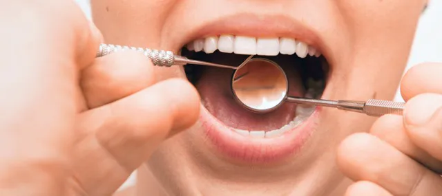 Dentist examining a patient's lower teeth with a mirror and scaler