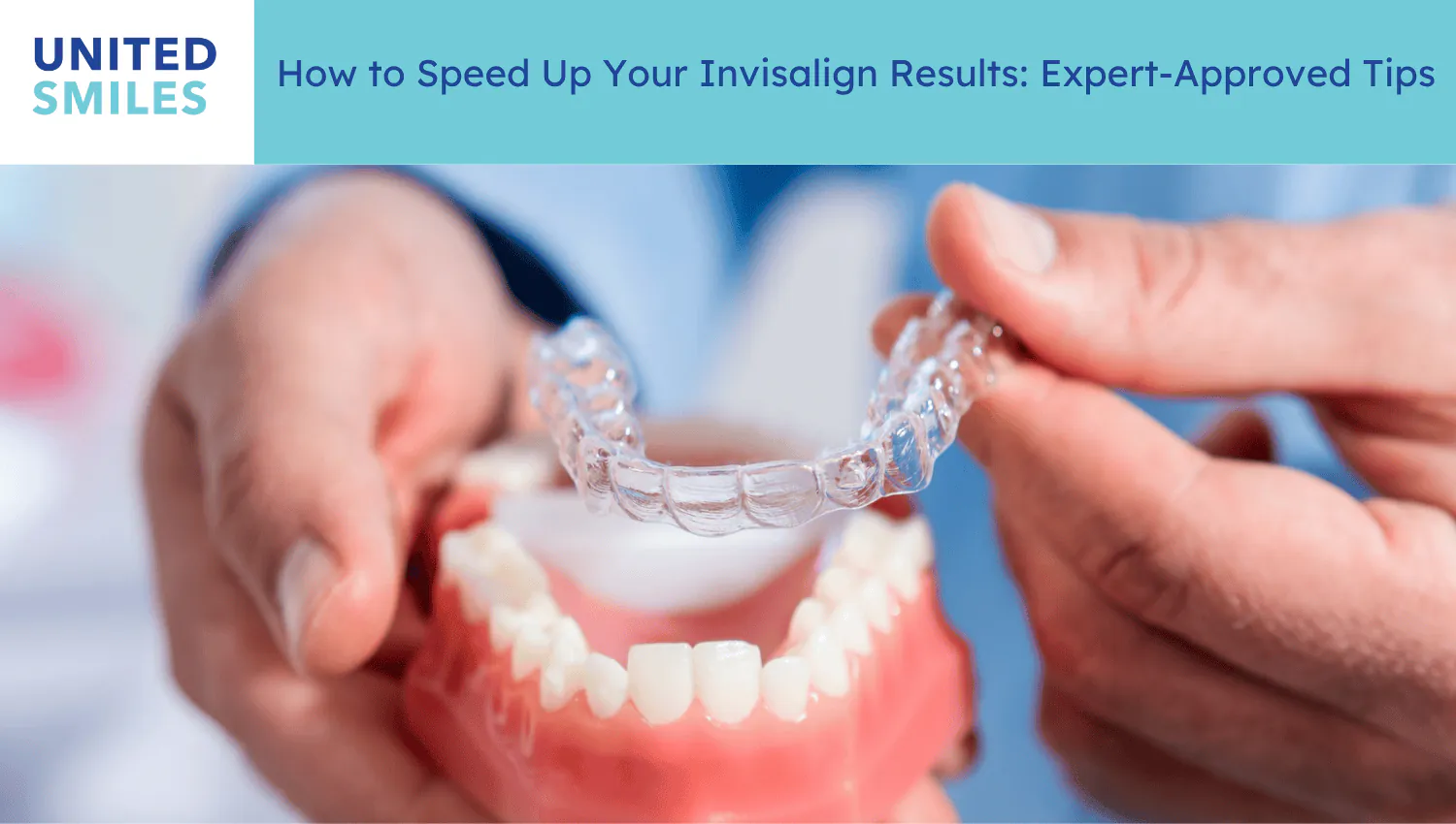 Hand holding a clear aligner above a model of teeth