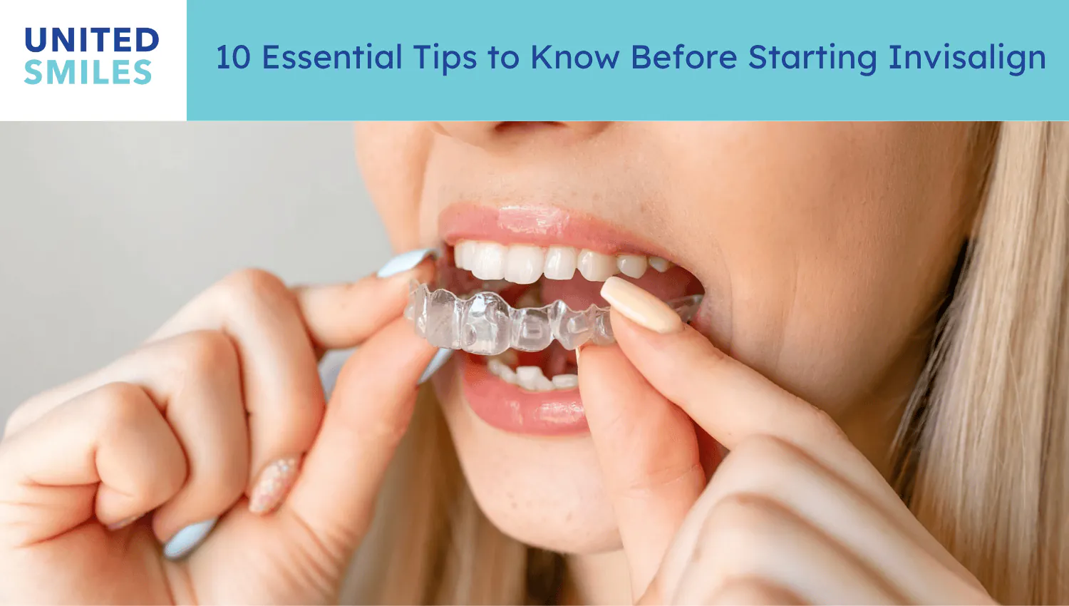 Woman placing a clear Invisalign aligner on her teeth