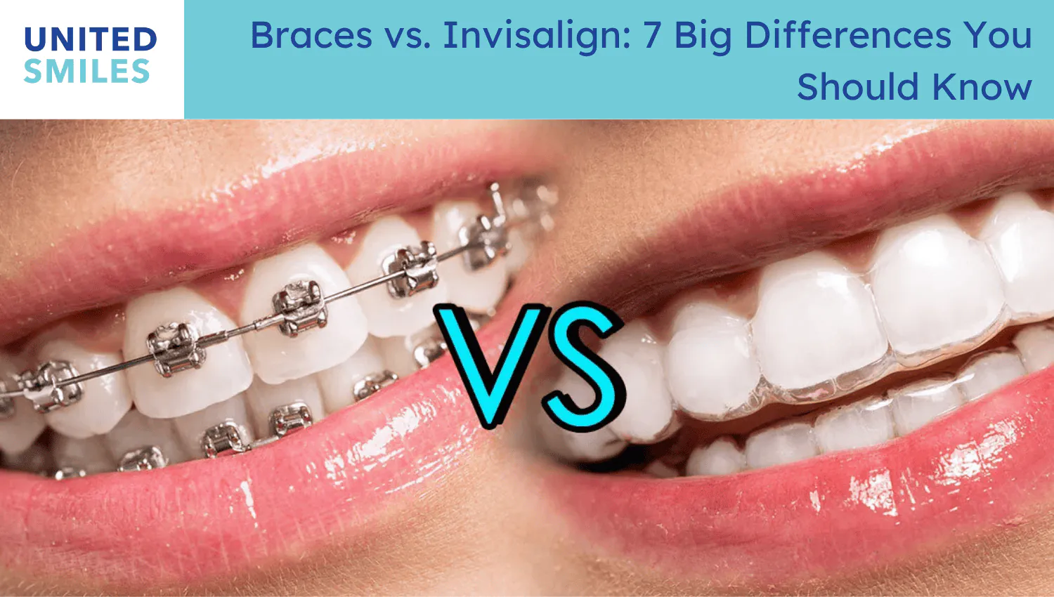 'Braces versus Invisalign' comparison showing metal braces and a clear aligner