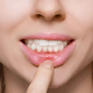 Close-up of a woman pointing to her healthy gums