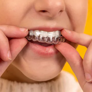 Close-up of a person inserting a clear aligner
