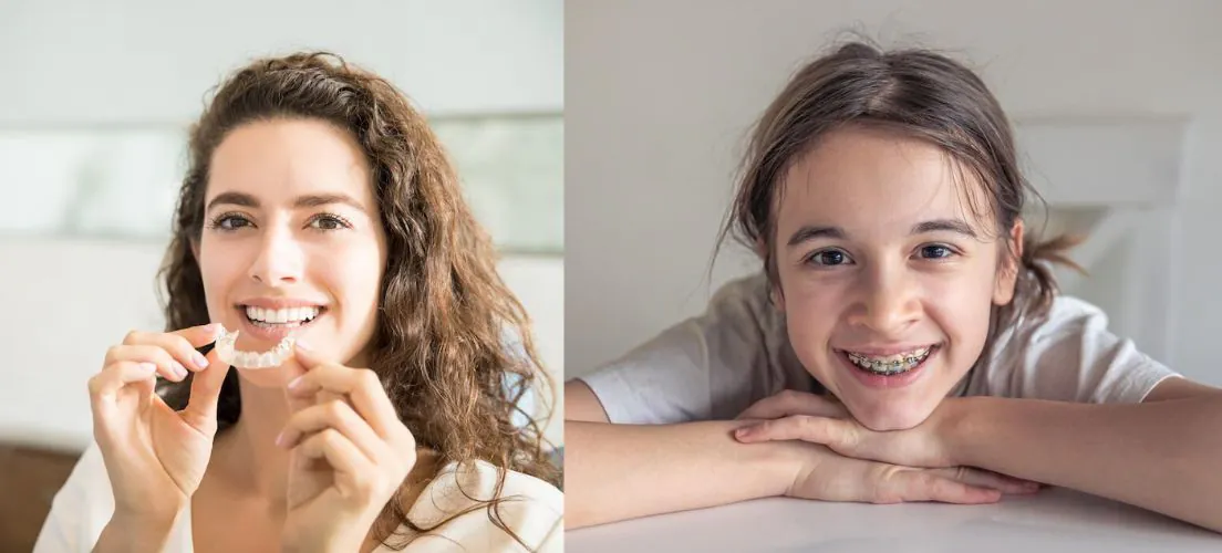 A woman wearing a clear aligner beside a girl wearing metal braces