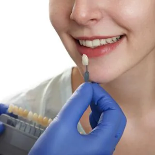 Dentist matching a veneer shade to a patient's smile