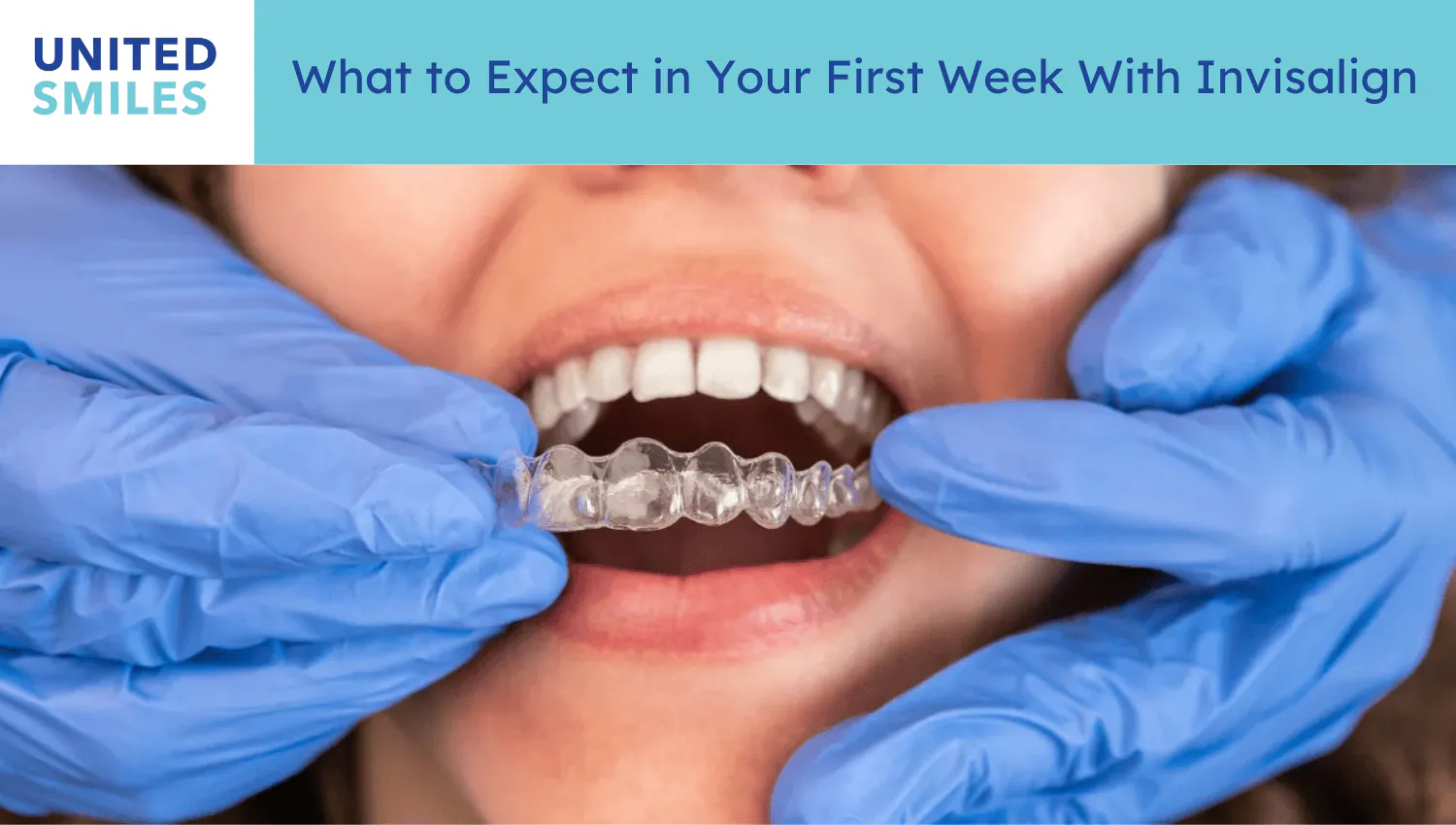 Dentist holding a clear aligner near a patient's mouth