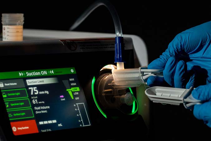 How Technology Helps Address GI Suite Challenges