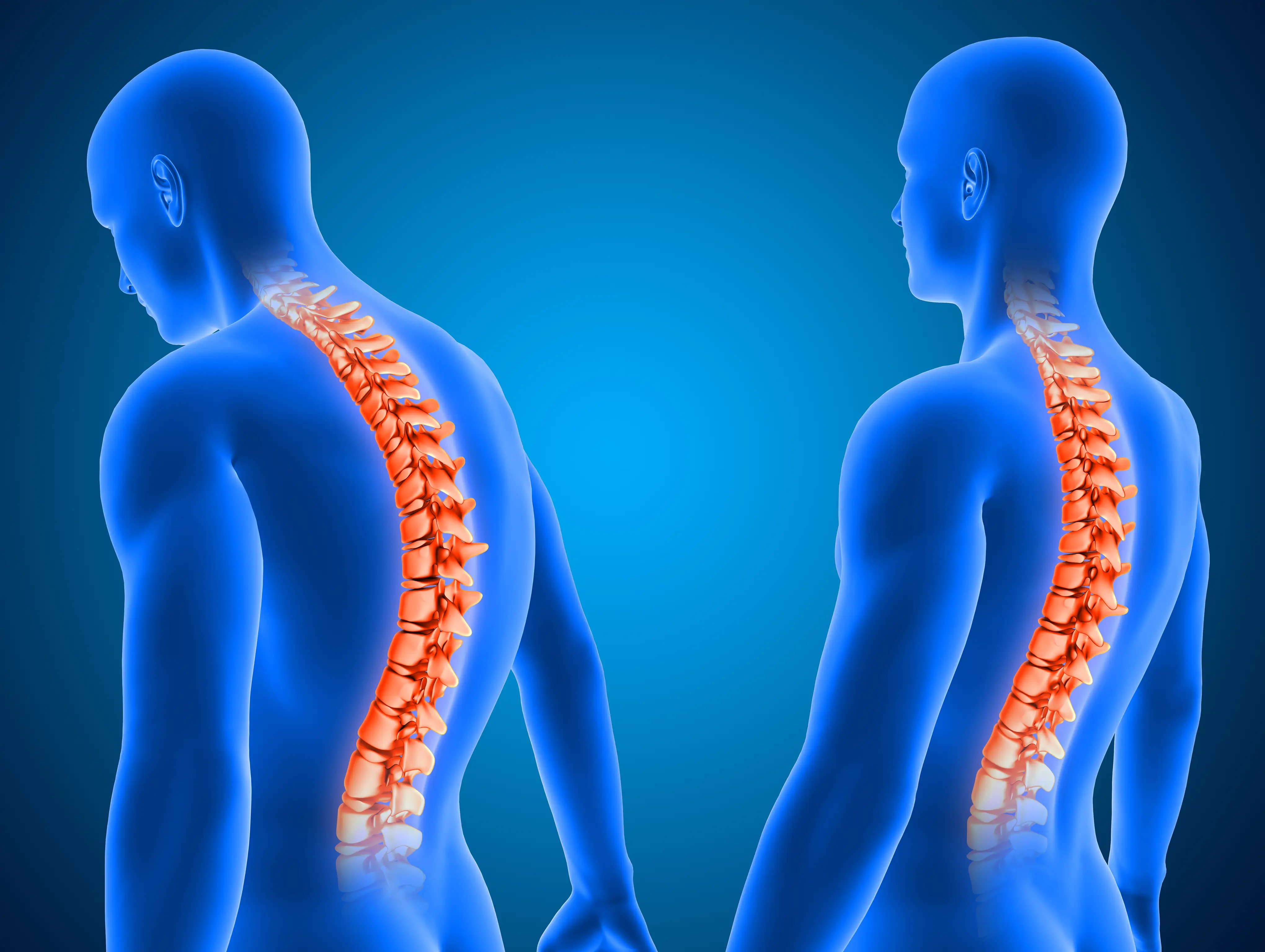 The Best Exercises For Better Posture