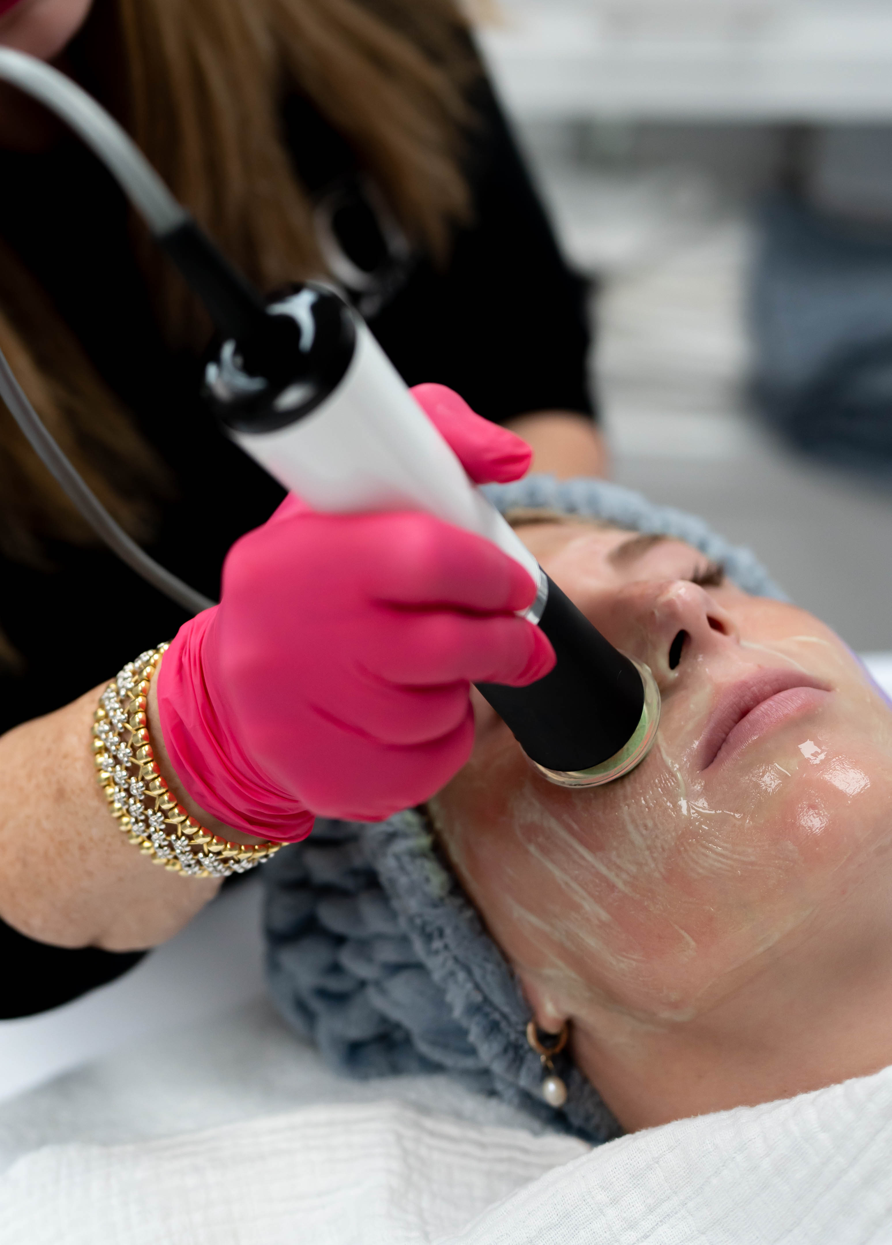 Hollywood Laser Peel with the Spectra laser from Lutronic