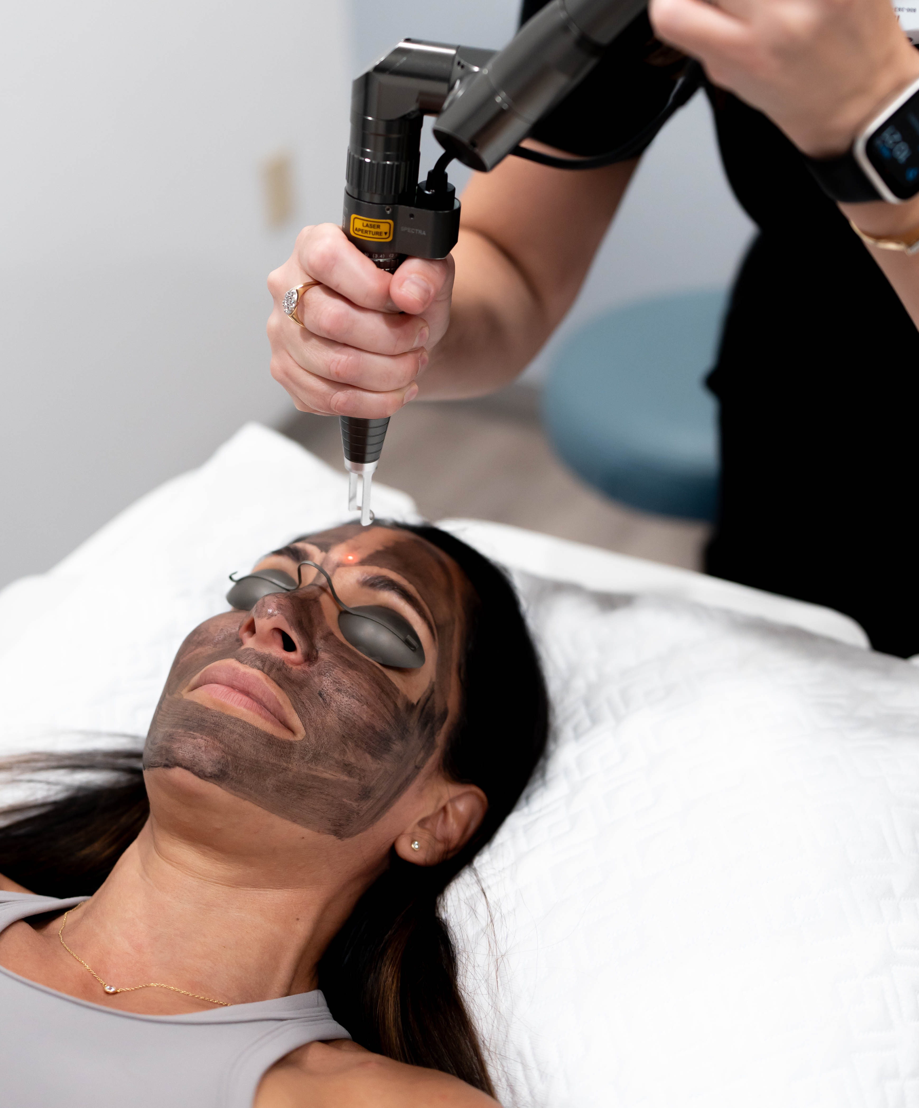 Hollywood Laser Peel with the Spectra laser from Lutronic