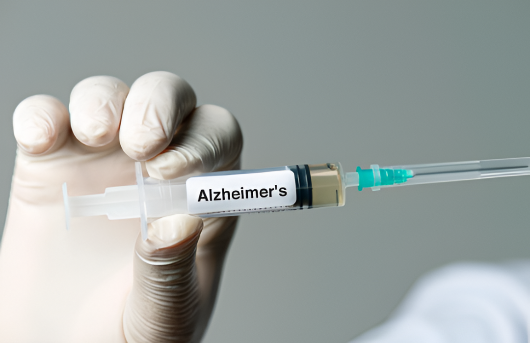 Científicos detectan un vínculo entre la pérdida de litio cerebral y el avance del Alzheimer
