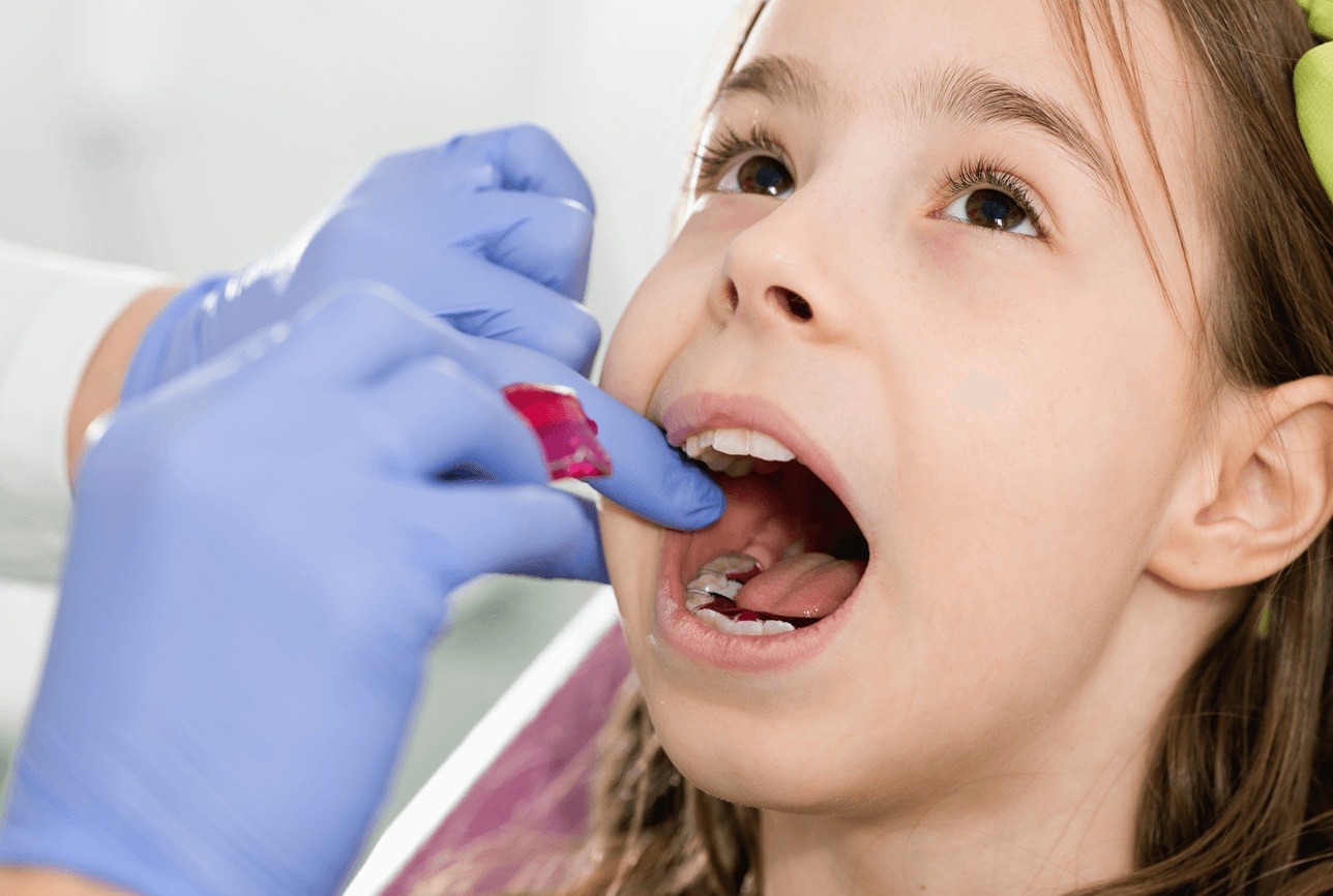 Child receiving a dental check-up for cavities at the best family dentist in Naperville.