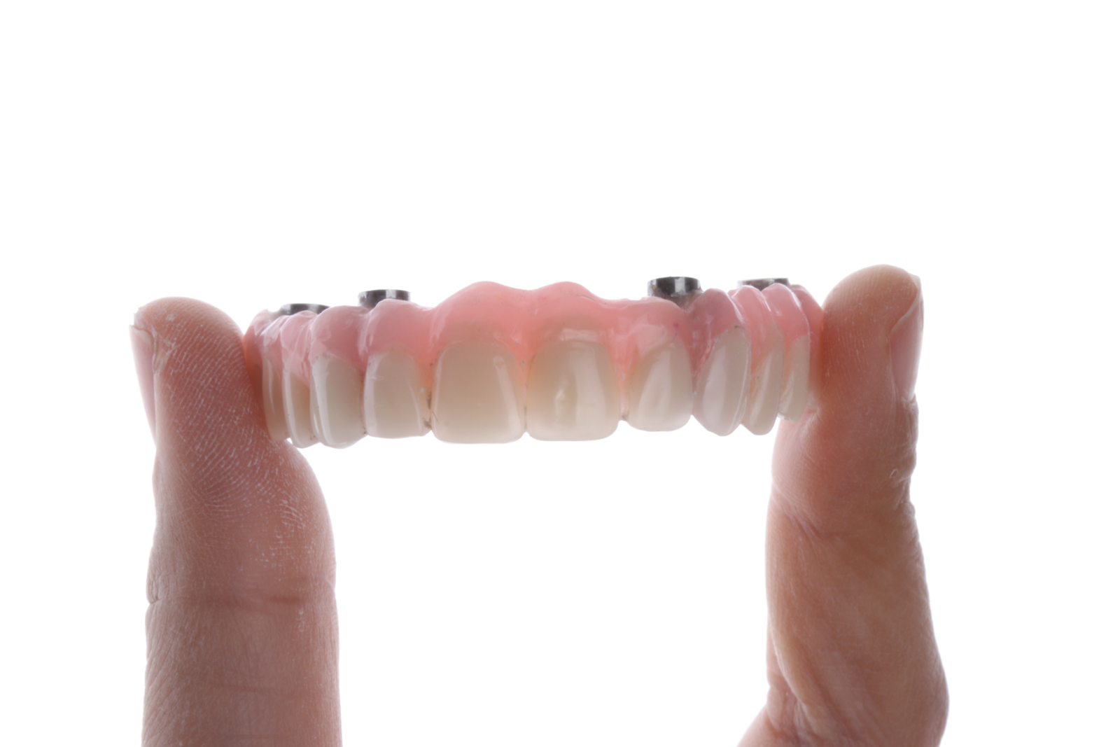 All-on-X Implants in Conover