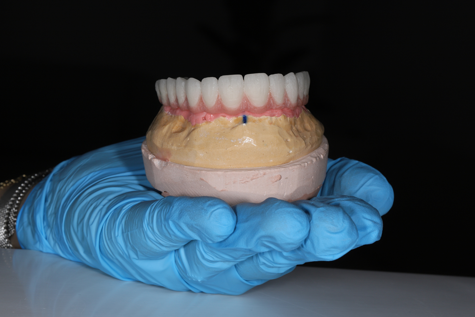 All-on-X Implants in Conover