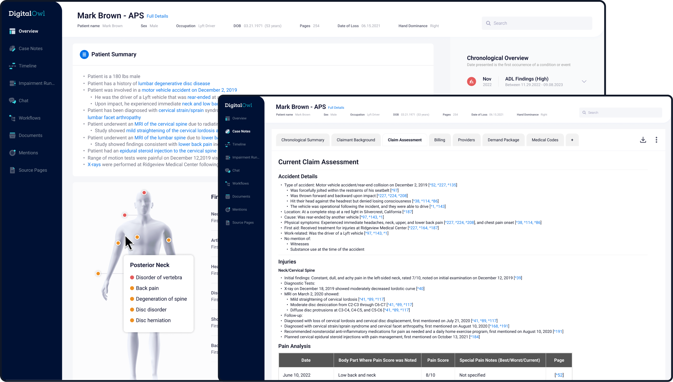 Bodily Injury Claims