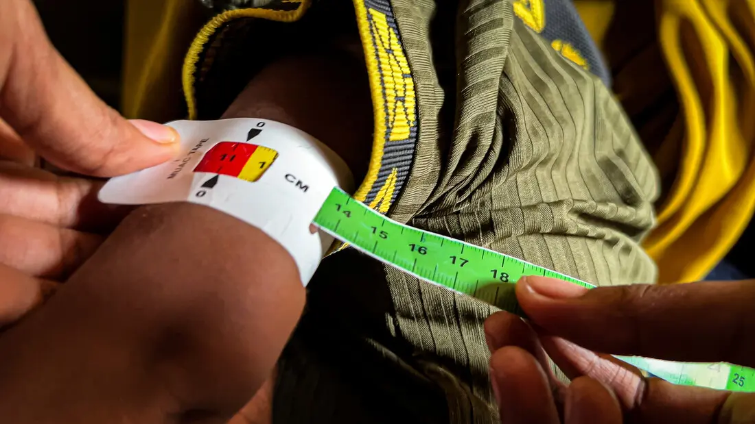  A child gets screened for malnutrition with the MUAC-method in a health facility in southern Somalia.