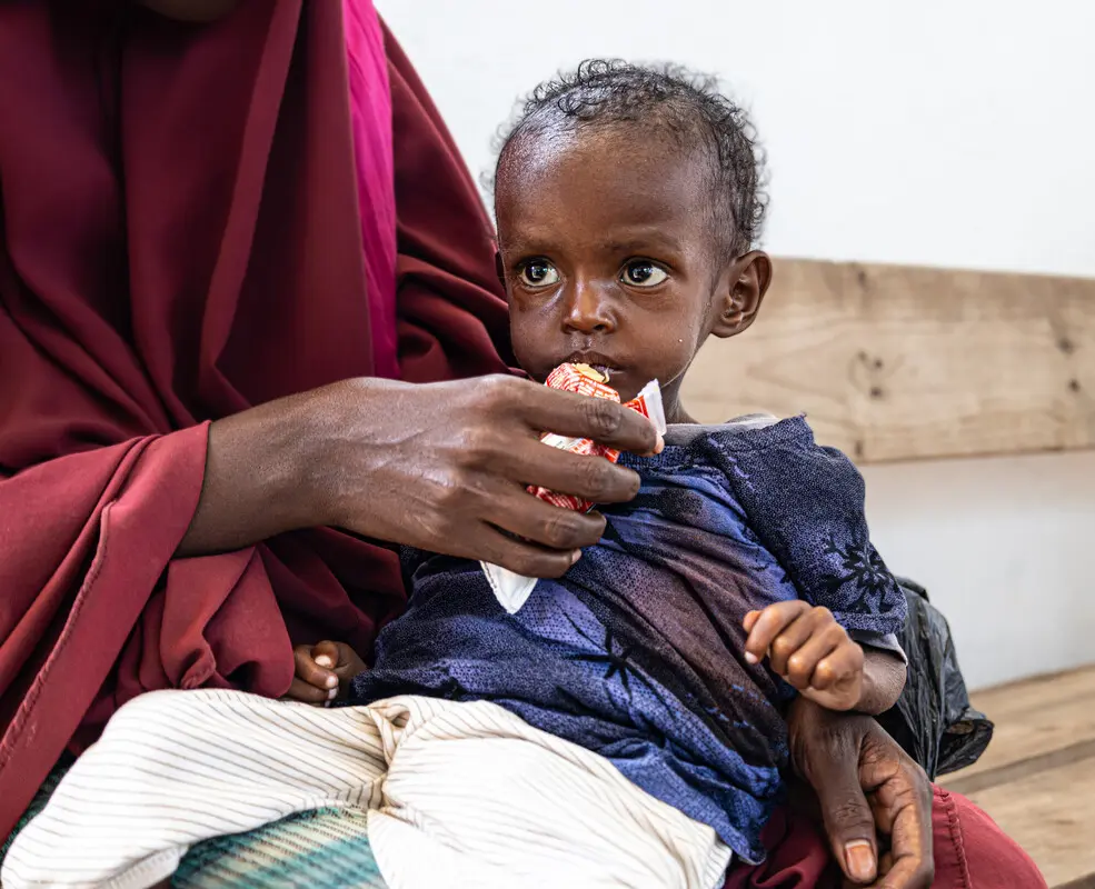 A mother helps her child to eat therapeutic food in a health facility in southern Somalia.
