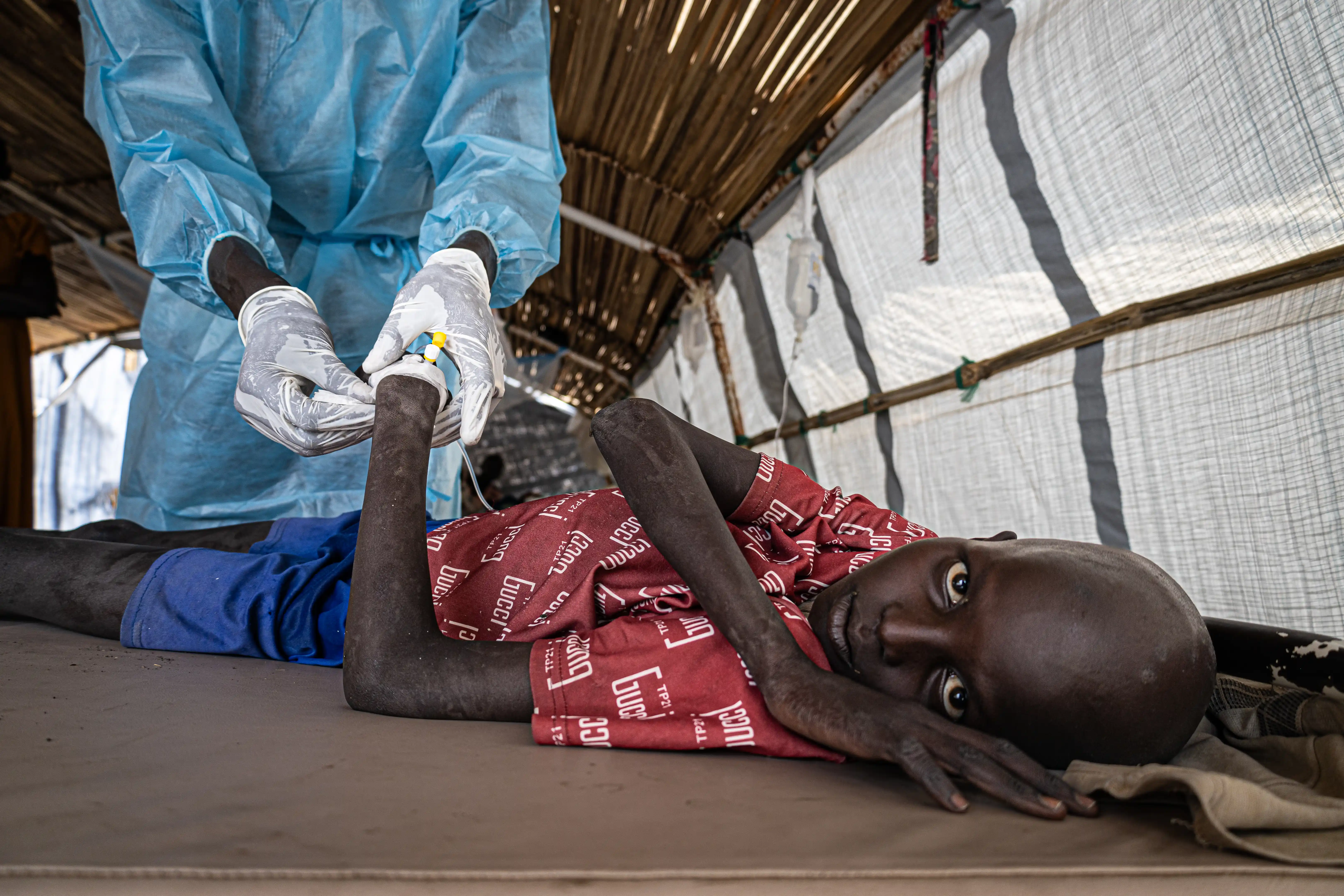 Close-up of gloved hands inserting an IV line into a child’s arm in a cholera treatment centre.