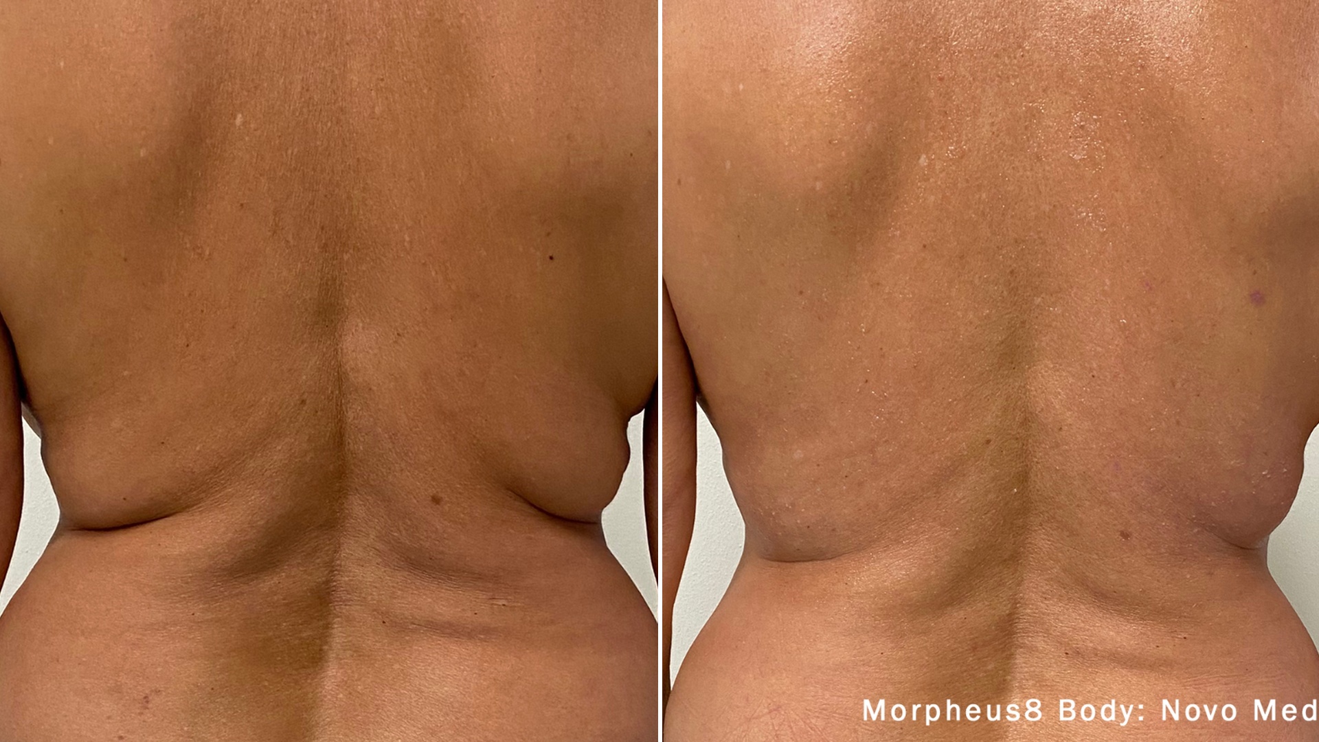 Tailored precision result