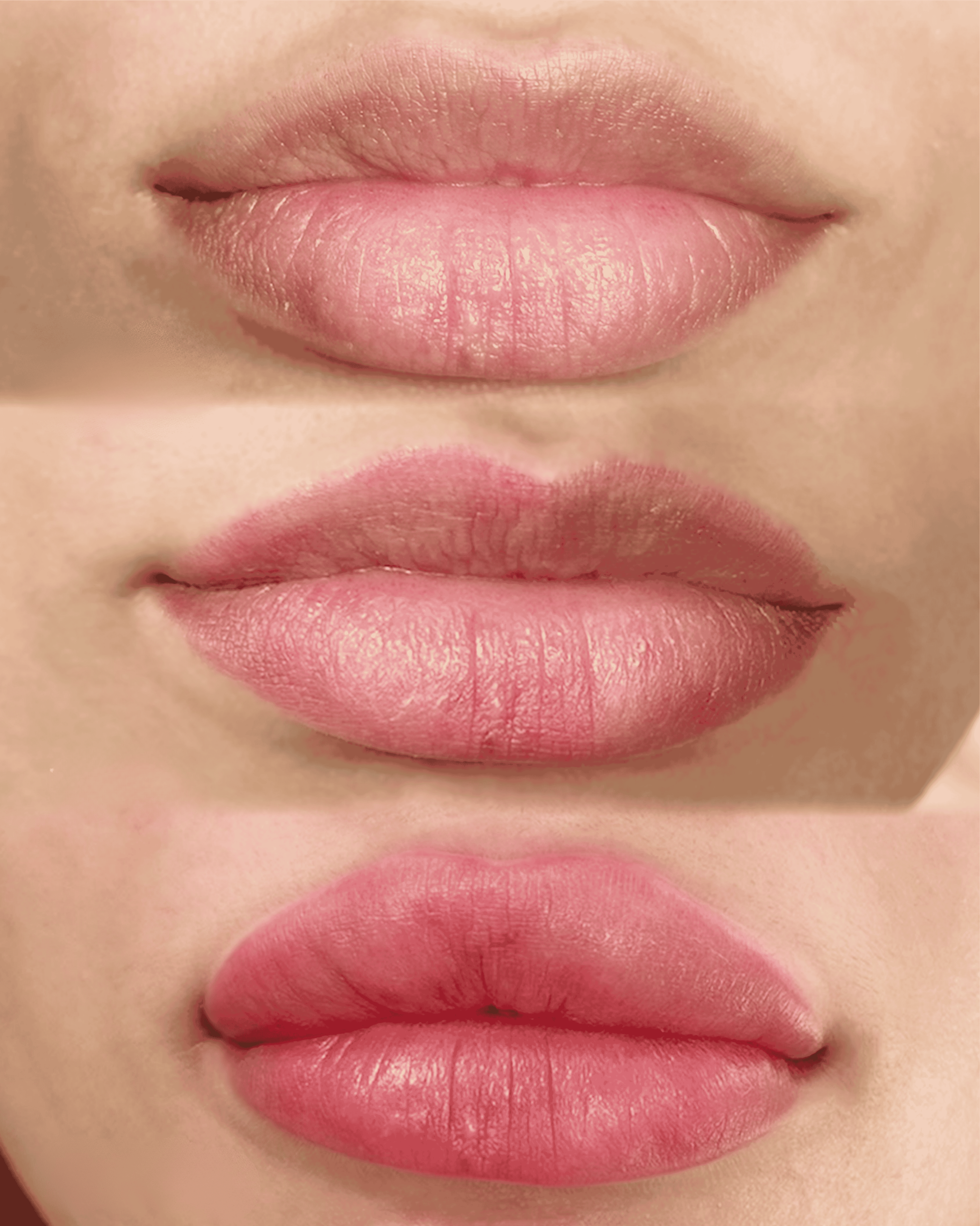 Lip Blush before, healed and right after result example