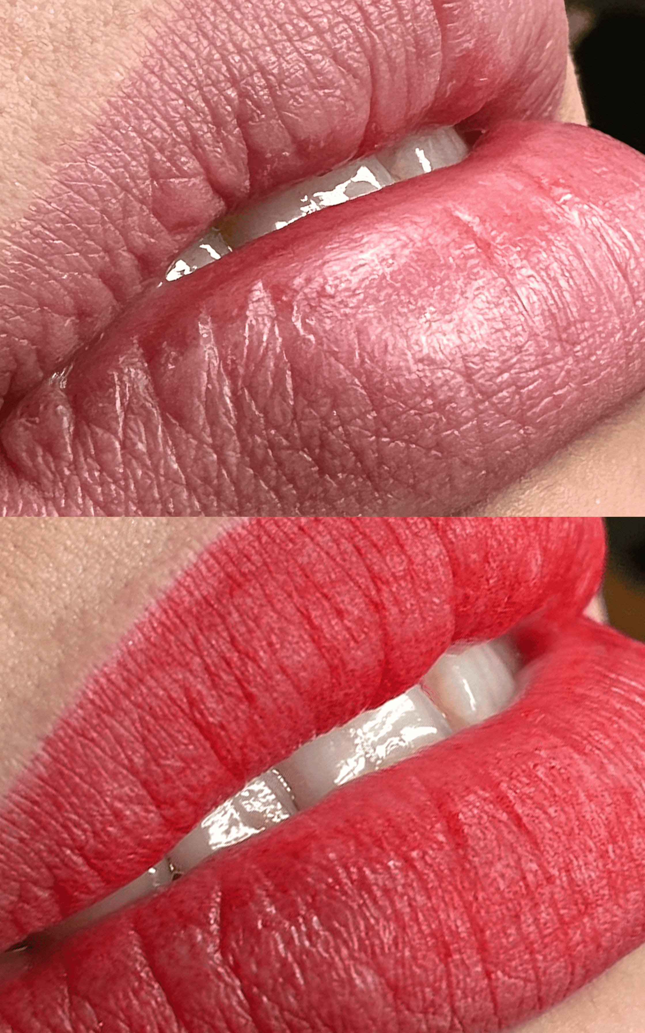 Before and after Lip Blush result example