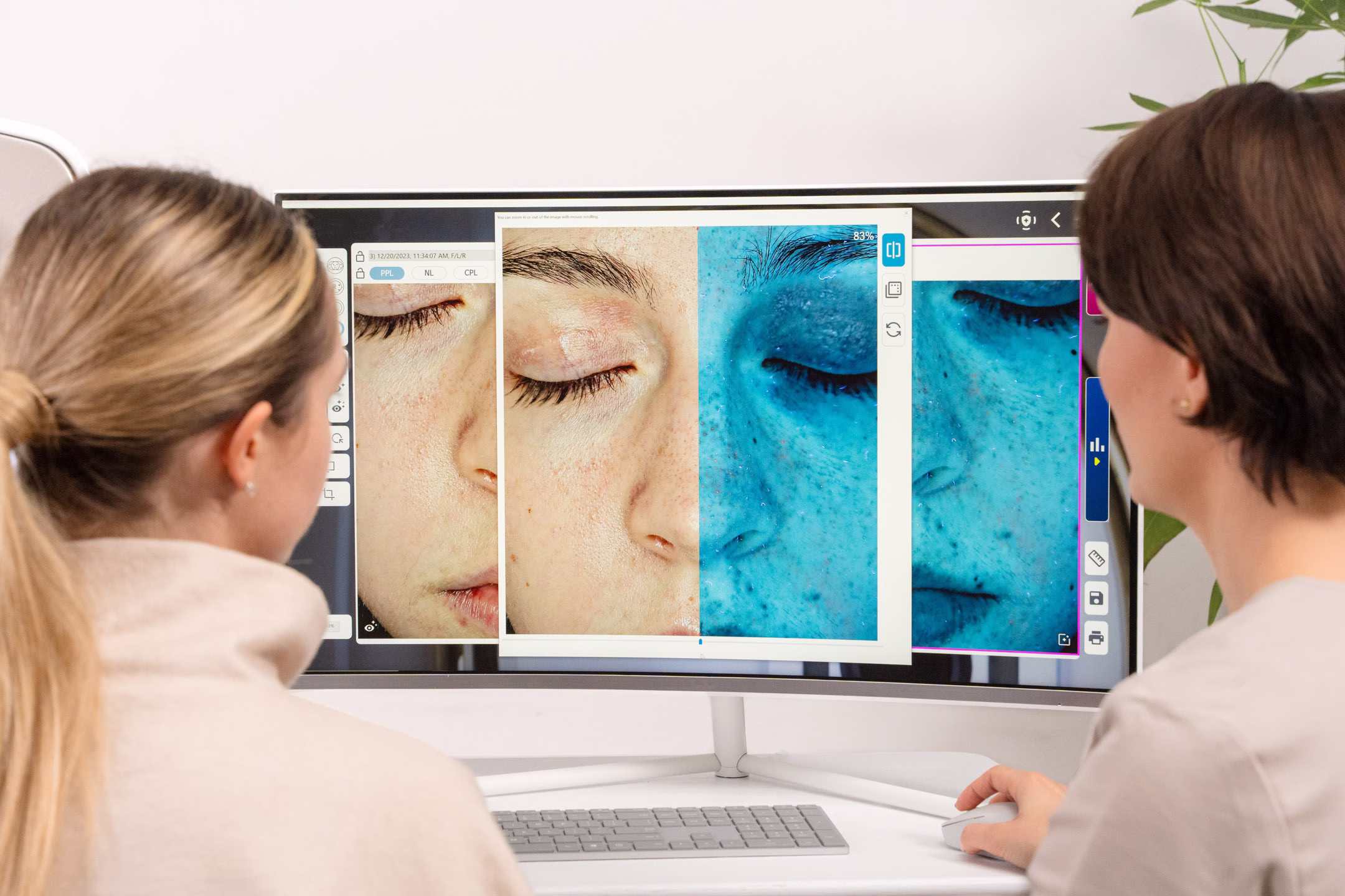 Analiza skóry światłem UV w gabinecie kosmetologicznym – diagnostyka głębokości przebarwień przed rozpoczęciem terapii