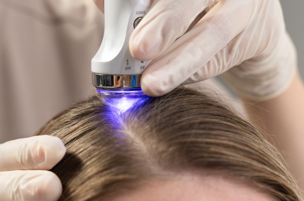 Analiza skóry głowy i włosów podczas diagnostyki urządzeniem Lumiscan Hair&Body